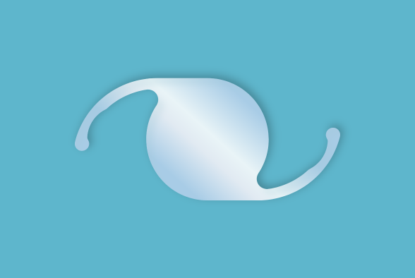 人工晶狀體